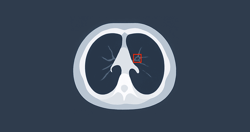 Predictive Tumour App