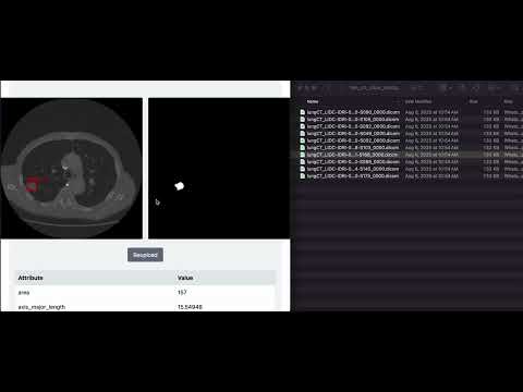 CMPT 340: Biomedical Computing CT Scan Demo